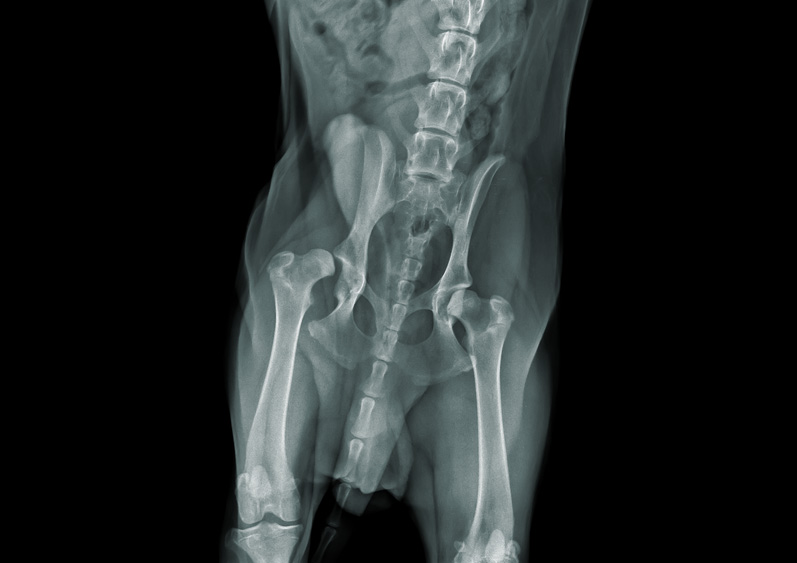 Radiographie